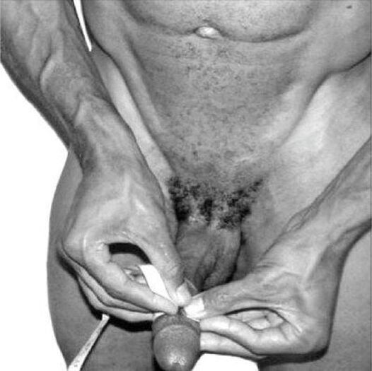 medición do pene antes da ampliación