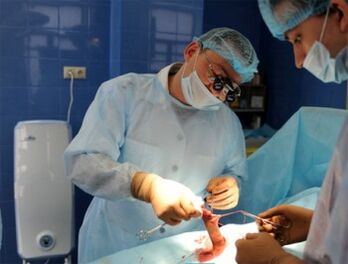 Cirurxía de ampliación do pene realizada por cirurxiáns